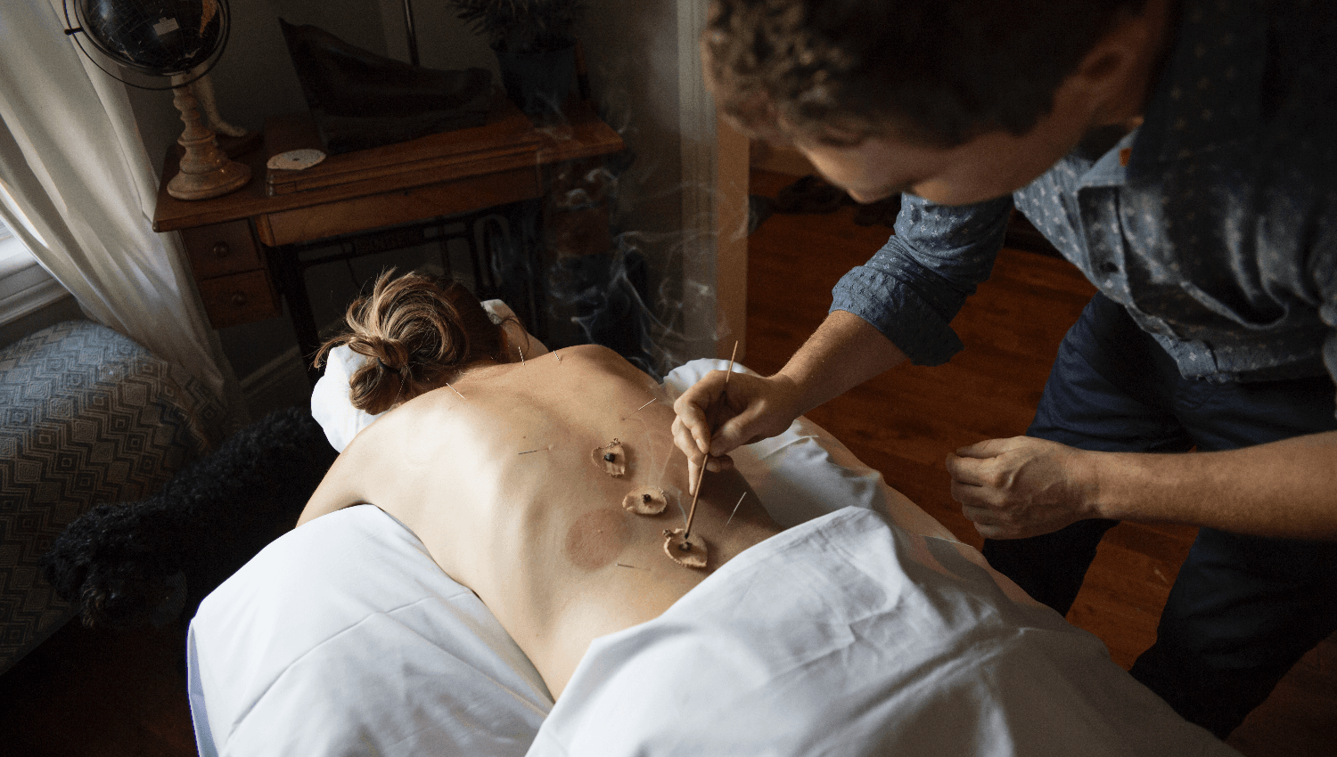 Image for Acupuncture